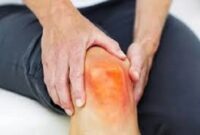 Ilustrasi penyakit asam urat