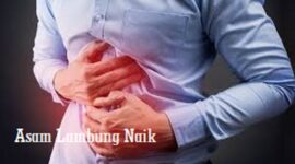 Ilustrasi Asam Lambung Naik.