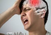 Ilustrasi Penyakit Stroke