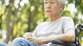 Ilustrasi kulit kering pada Lansia