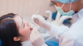 Ilustrasi pemeriksaan kesehatan gigi kini ditanggung BPJS