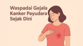 Ilustrasi Kanker Payu Dara. 
