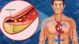 Ilustrasi kolesterol