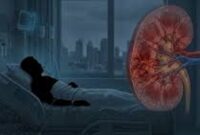 Ilustrasi penyakit TB Ginjal