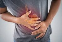 Ilustrasi gejala asam lambung