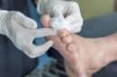 Luka pada pasien pengidap Diabetes susah sembuh