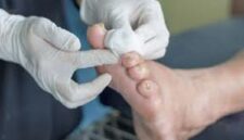 Luka pada pasien pengidap Diabetes susah sembuh