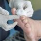 Luka pada pasien pengidap Diabetes susah sembuh