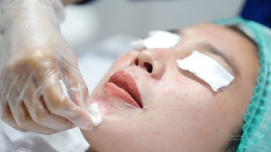 Tanda Kulit Wajah Butuh Eksfoliasi Segera